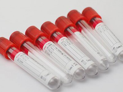 CE和ISO认证无菌医用PET红色帽顶血样采集血清管